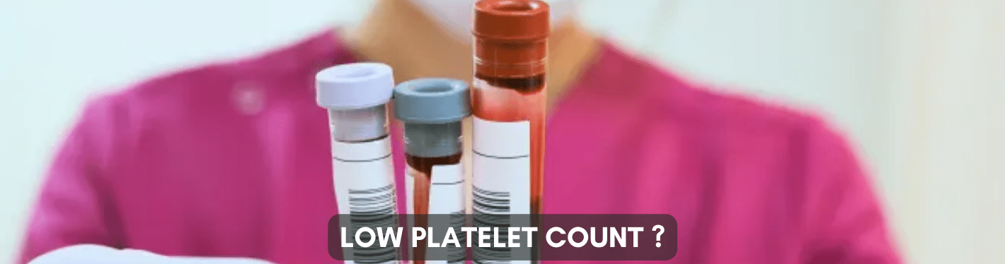 Low Platelet Count: 7 Easy Ways To Maintain The Right And Healthy Count Of Platelets - Dr Trust