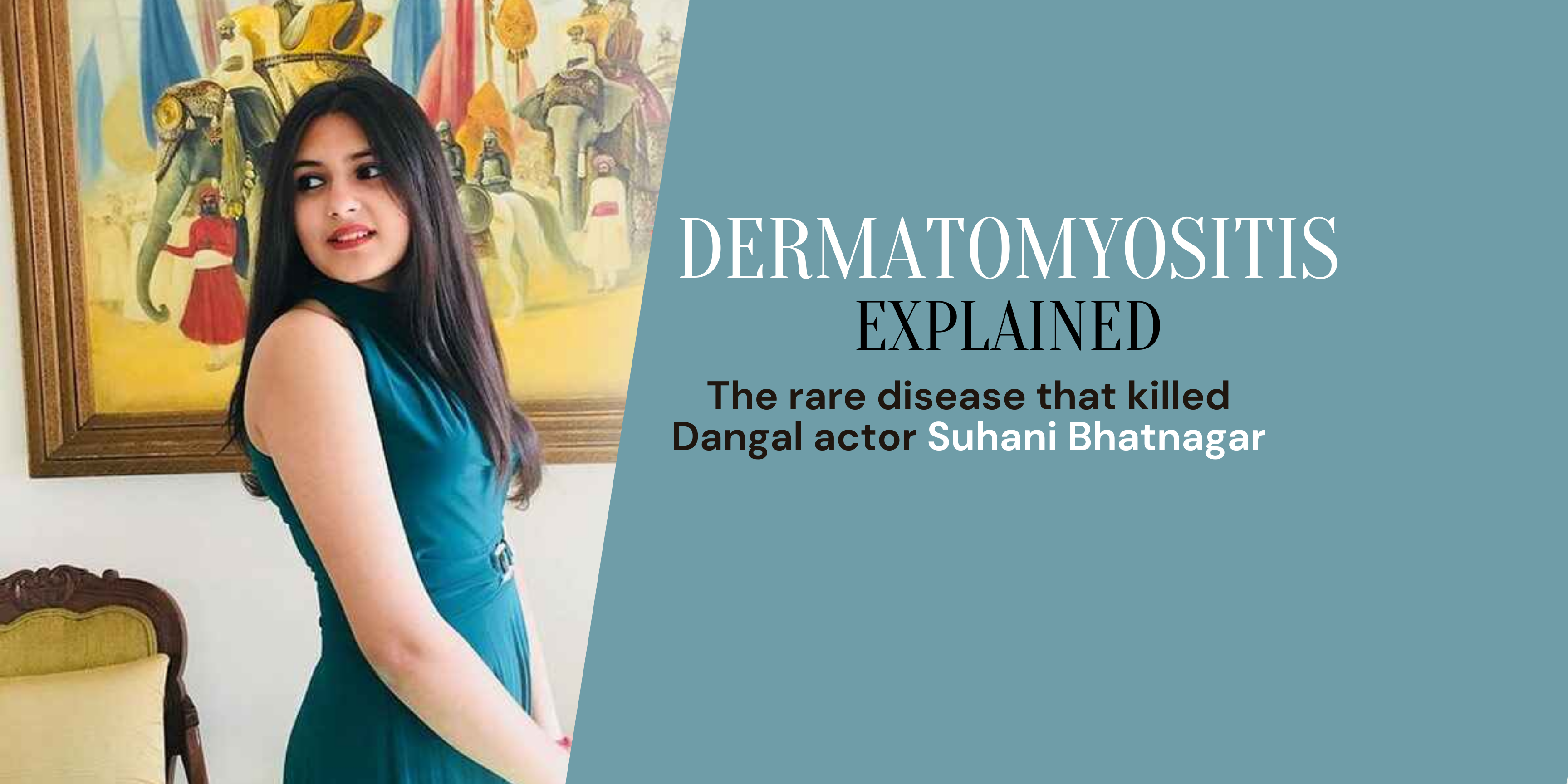 What Is Dermatomyositis? The Rare Disease Behind The Tragic Loss Of The "Dangal" Girl Suhani Bhatnagar - Dr Trust