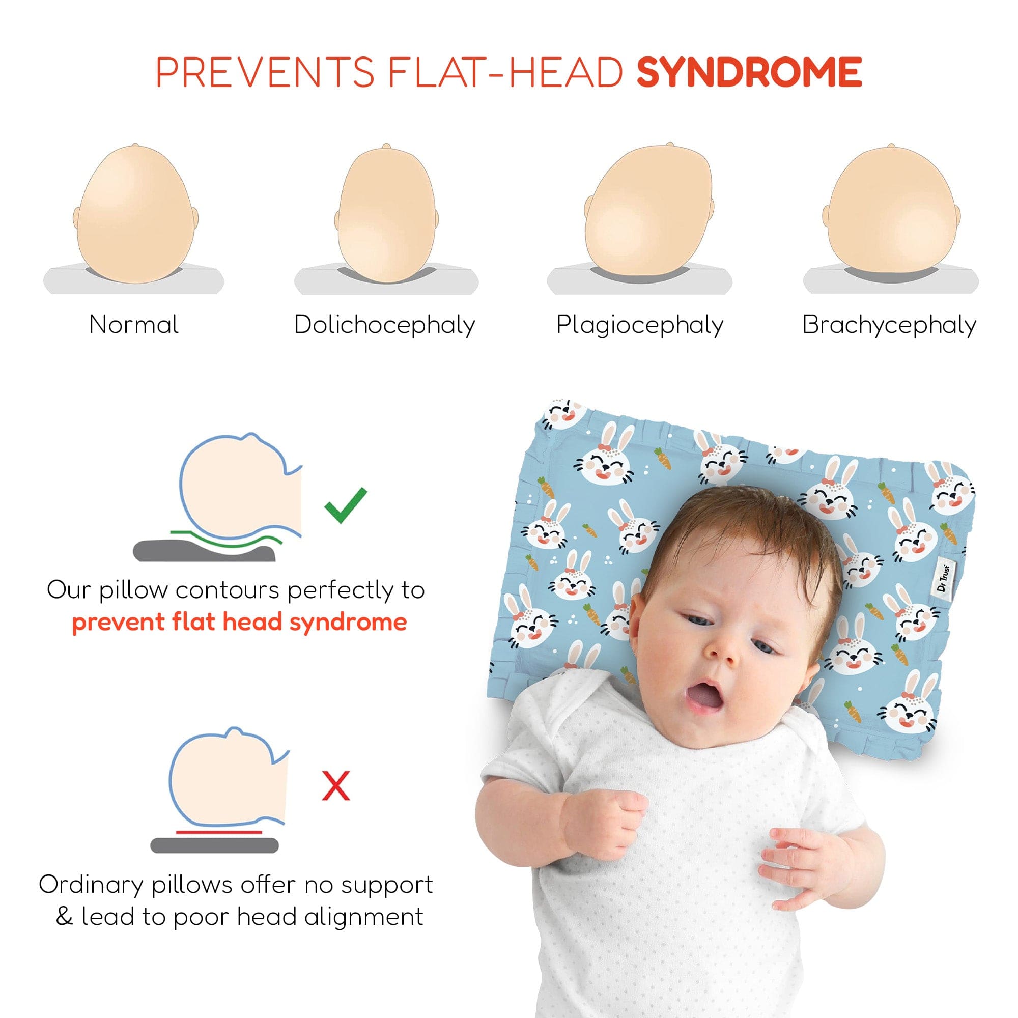 Dr Trust USA Dr Trust USA 380 TRUBABY Mustard Seed Baby Head Shaping Pillow with Removable Cover, 0 Month to 1 Year Flat Head Syndrome Prevention Rai Pillow for Head Shaping, Neck Support & Sound Sleep (Size 31x27 cm)