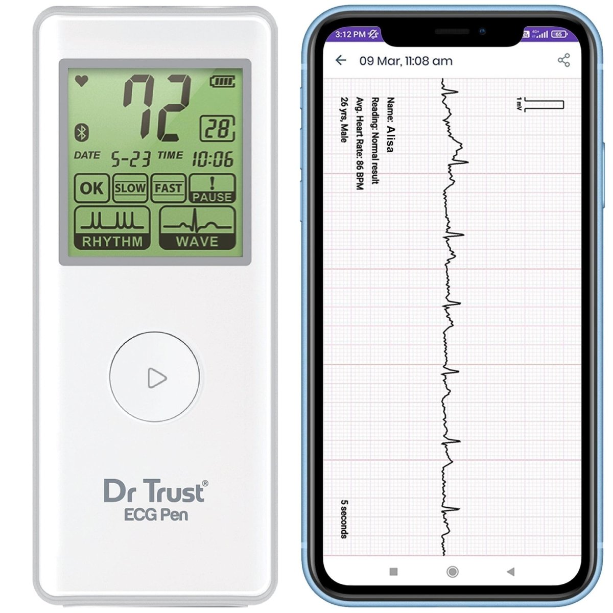 Dr Trust USA Portable Bluetooth ECG/EKG Machine 1201