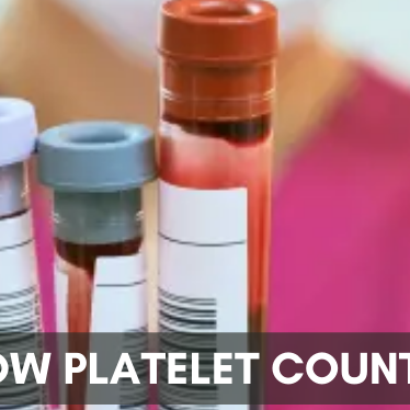 Low Platelet Count: 7 Easy Ways To Maintain The Right And Healthy Count Of Platelets