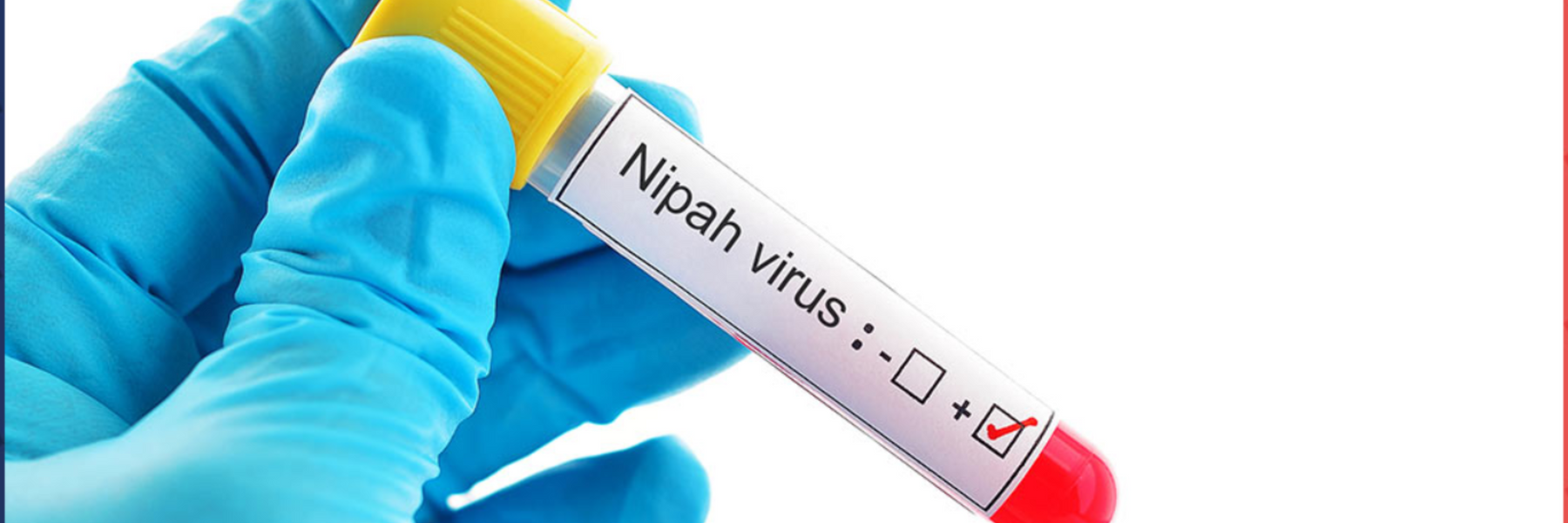 Health Emergency:Nipah Virus Strikes Again, What Do You Need To Know About It, A Virus With  High Mortality Rate