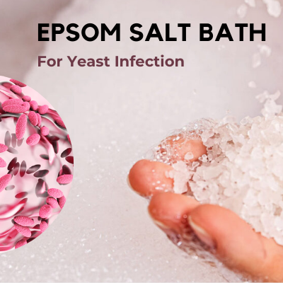 Benefits Epsom Salt Body Soak On Bacterial Yeast Infection PNG