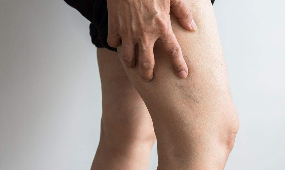 Air Compression Therapy May Help Cure Blood Clots and Stroke Risk amongst COVID-19 Patients - Dr Trust