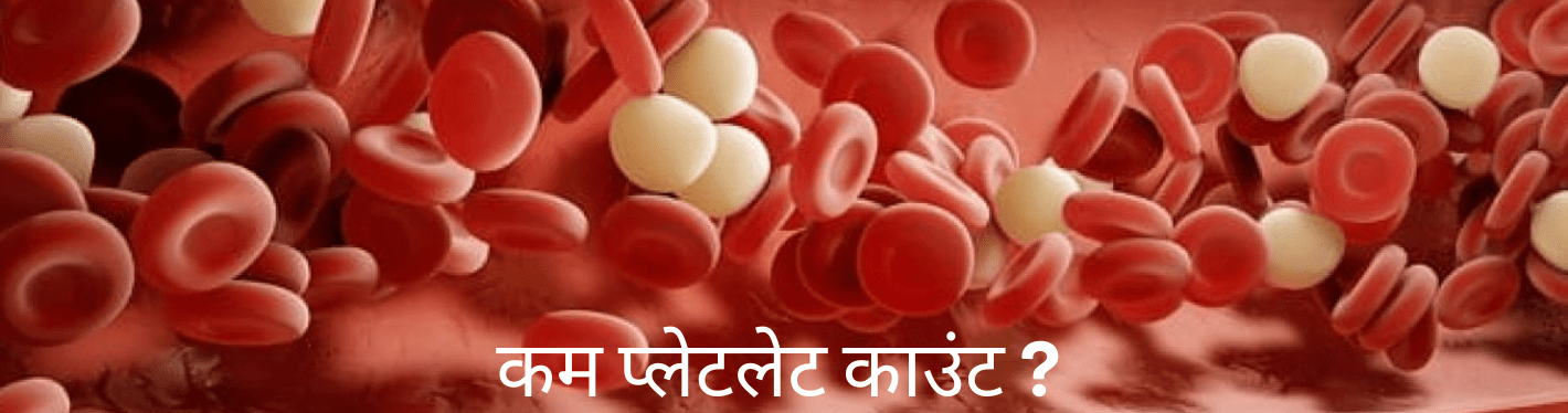 कम प्लेटलेट काउंट: क्या आप कम प्लेटलेट काउंट की समस्या का सही उपचार जानते हैं? - Dr Trust