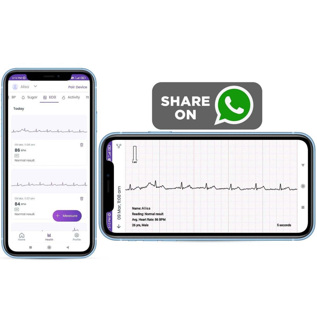 Dr Trust USA Portable Bluetooth ECG/EKG Machine 1201